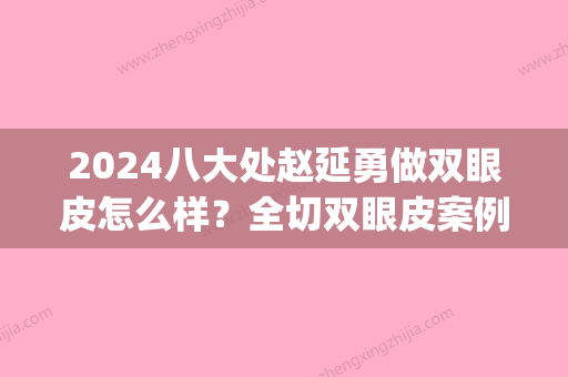 2024八大处赵延勇做双眼皮怎么样？全切双眼皮案例分享(赵延勇双眼皮价格)