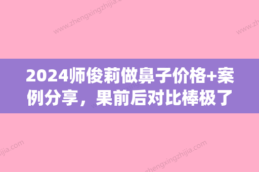 2024师俊莉做鼻子价格+案例分享，果前后对比棒极了！(师俊莉做鼻子贵吗)