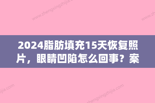 2024脂肪填充15天恢复照片，眼睛凹陷怎么回事？案例解答(脂肪胶填充眼部凹陷几天消肿)