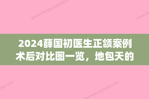 2024薛国初医生正颌案例术后对比图一览，地包天的福音来了！(薛国初正颌手术怎么样)