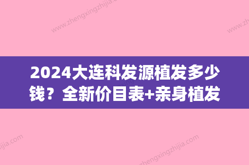 2024大连科发源植发多少钱？全新价目表+亲身植发案例展示(植发周期效果图)