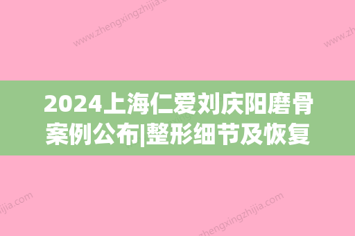 2024上海仁爱刘庆阳磨骨案例公布|整形细节及恢复果图分享