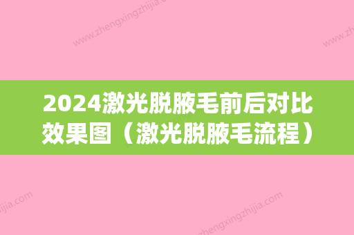 2024激光脱腋毛前后对比效果图（激光脱腋毛流程）(2024激光脱毛价格表)