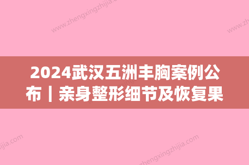 2024武汉五洲丰胸案例公布｜亲身整形细节及恢复果图展示(武汉五洲整形美容医院医生)