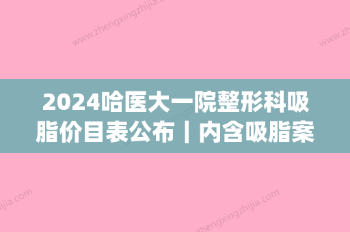 2024哈医大一院整形科吸脂价目表公布｜内含吸脂案例及亲身案例(哈尔滨吸脂手术价格)