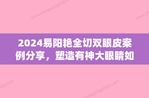 2024易阳艳全切双眼皮案例分享，塑造有神大眼睛如此轻松！(易艳阳双眼皮手术案例)