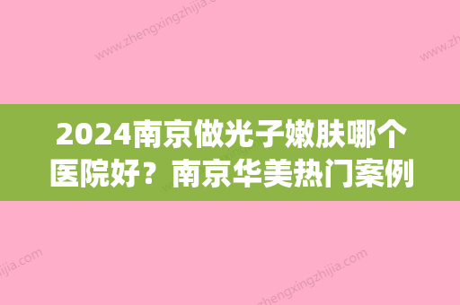 2024南京做光子嫩肤哪个医院好？南京华美热门案例公布(南京哪里做光子嫩肤比较好)