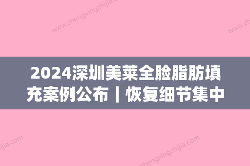 2024深圳美莱全脸脂肪填充案例公布｜恢复细节集中一览(全脸脂肪填充成功案例)