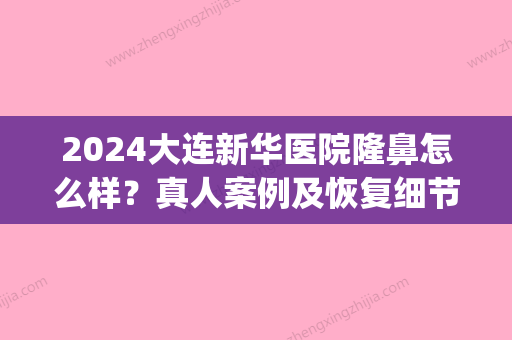 2024大连新华医院隆鼻怎么样？真人案例及恢复细节分享(大连新华医院整形科)