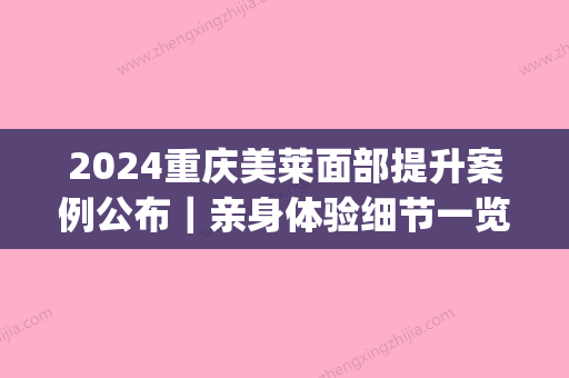 2024重庆美莱面部提升案例公布｜亲身体验细节一览(重庆美莱医疗整形)