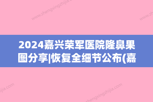 2024嘉兴荣军医院隆鼻果图分享|恢复全细节公布(嘉兴荣军医院整形科)