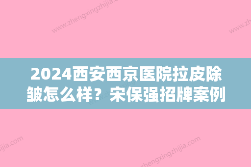 2024西安西京医院拉皮除皱怎么样？宋保强招牌案例及果图分享