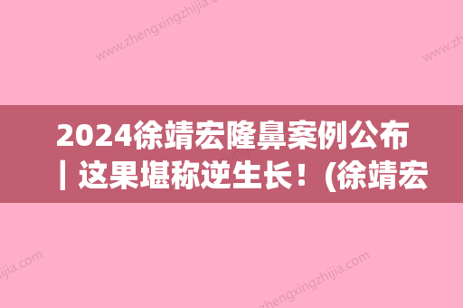 2024徐靖宏隆鼻案例公布｜这果堪称逆生长！(徐靖宏双眼皮)