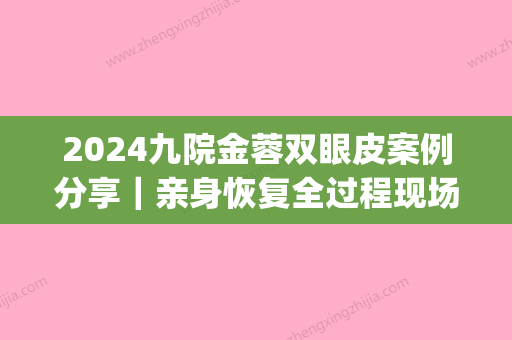 2024九院金蓉双眼皮案例分享｜亲身恢复全过程现场直播(上海九院金蓉医生做的全切双眼皮)