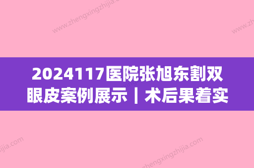 2024117医院张旭东割双眼皮案例展示｜术后果着实不错！(张丹丹割双眼皮)