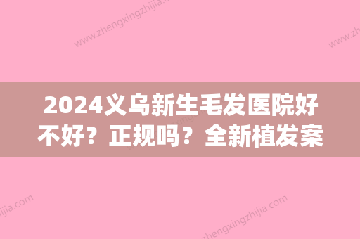 2024义乌新生毛发医院好不好？正规吗？全新植发案例公布(义乌新生毛发医院地址)