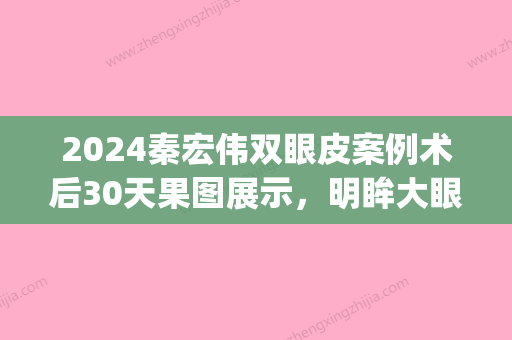 2024秦宏伟双眼皮案例术后30天果图展示	，明眸大眼轻松拥有(双眼皮手术3天恢复图)