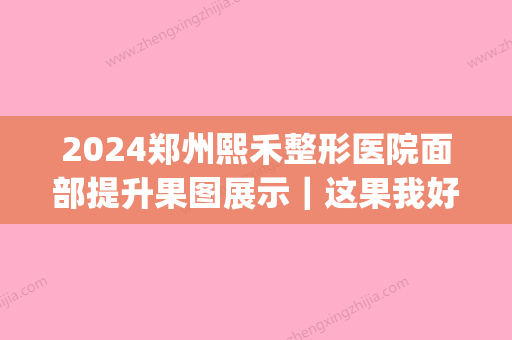 2024郑州熙禾整形医院面部提升果图展示｜这果我好喜欢(郑州熙禾整形医院图片)