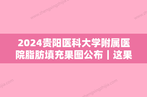 2024贵阳医科大学附属医院脂肪填充果图公布｜这果让人心动