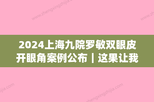 2024上海九院罗敏双眼皮开眼角案例公布｜这果让我爱了~(上海九院周慧敏割双眼皮)