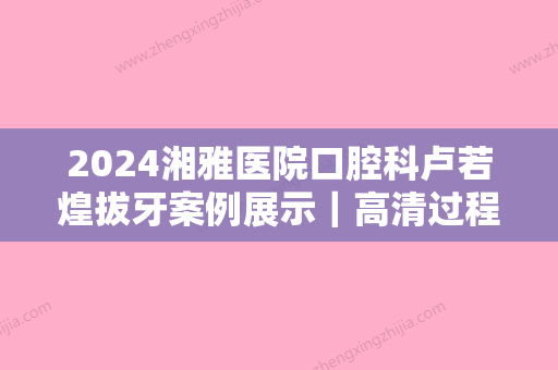 2024湘雅医院口腔科卢若煌拔牙案例展示｜高清过程图公布