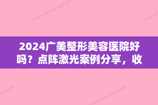 2024广美整形美容医院好吗？点阵激光案例分享，收费详情表2024更新~