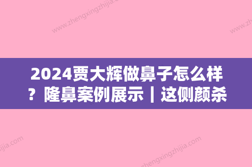 2024贾大辉做鼻子怎么样？隆鼻案例展示｜这侧颜杀真是绝了