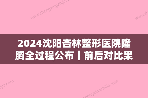 2024沈阳杏林整形医院隆胸全过程公布｜前后对比果让人眼红