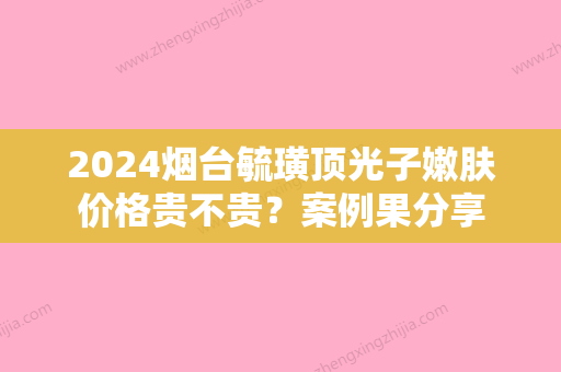 2024烟台毓璜顶光子嫩肤价格贵不贵？案例果分享