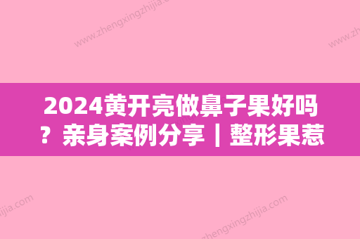 2024黄开亮做鼻子果好吗？亲身案例分享｜整形果惹人眼~