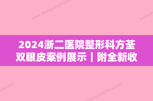 2024浙二医院整形科方荃双眼皮案例展示｜附全新收费标准