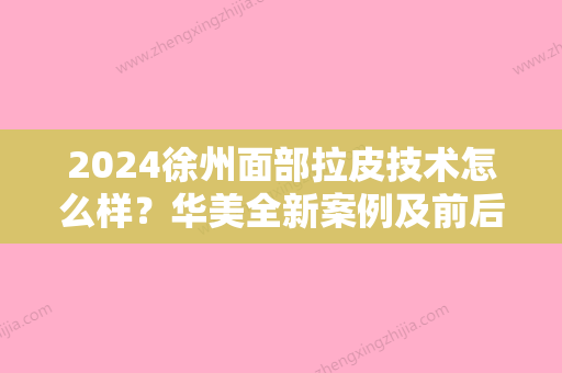 2024徐州面部拉皮技术怎么样？华美全新案例及前后对比图展示