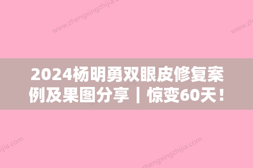 2024杨明勇双眼皮修复案例及果图分享｜惊变60天！