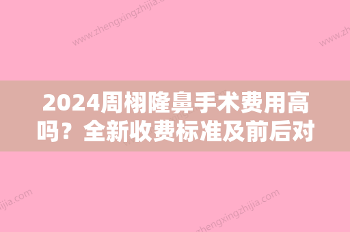 2024周栩隆鼻手术费用高吗？全新收费标准及前后对比图分享