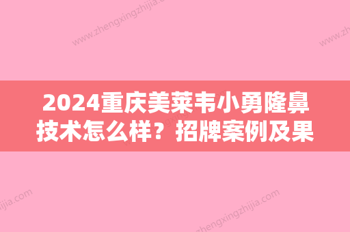 2024重庆美莱韦小勇隆鼻技术怎么样？招牌案例及果图曝光