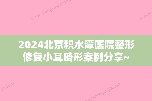 2024北京积水潭医院整形修复小耳畸形案例分享~