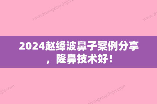 2024赵绛波鼻子案例分享，隆鼻技术好！