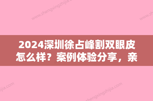 2024深圳徐占峰割双眼皮怎么样？案例体验分享，亲妈款！