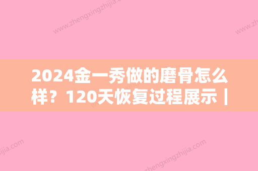 2024金一秀做的磨骨怎么样？120天恢复过程展示｜内含亲身感悟