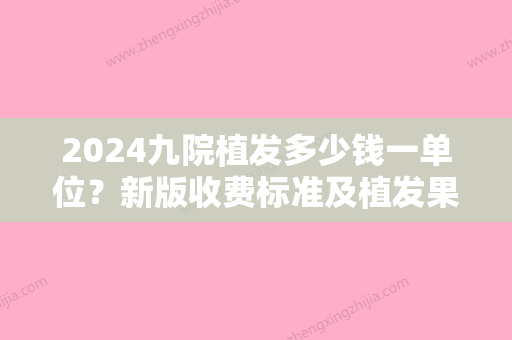 2024九院植发多少钱一单位？新版收费标准及植发果图