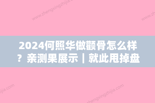 2024何照华做颧骨怎么样？亲测果展示｜就此甩掉盘子脸~