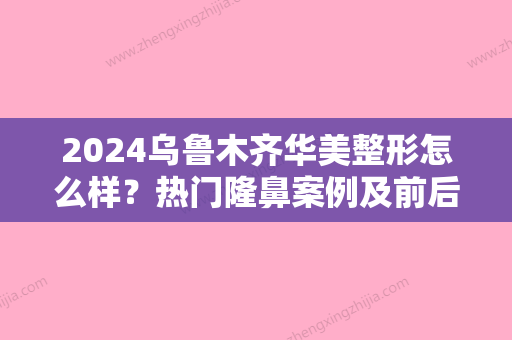 2024乌鲁木齐华美整形怎么样？热门隆鼻案例及前后对比图展示