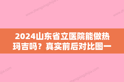 2024山东省立医院能做热玛吉吗？真实前后对比图一览~