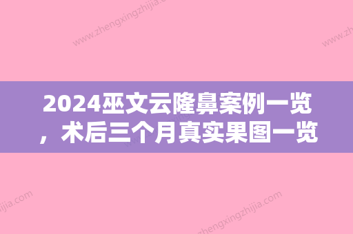 2024巫文云隆鼻案例一览，术后三个月真实果图一览~