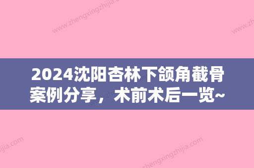 2024沈阳杏林下颌角截骨案例分享，术前术后一览~