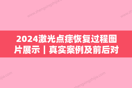 2024激光点痣恢复过程图片展示｜真实案例及前后对比图一览