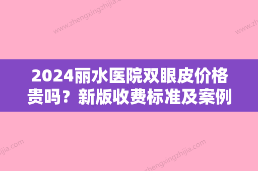 2024丽水医院双眼皮价格贵吗？新版收费标准及案例展示