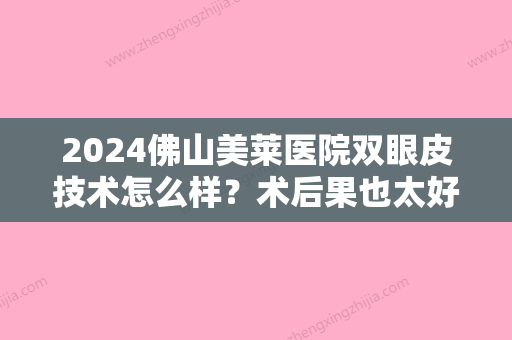 2024佛山美莱医院双眼皮技术怎么样？术后果也太好看了吧