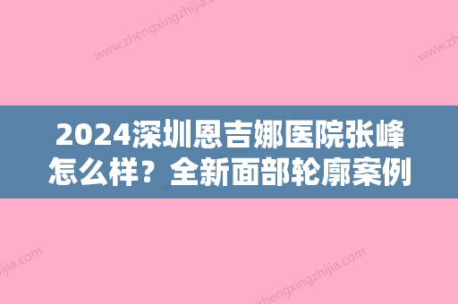 2024深圳恩吉娜医院张峰怎么样？全新面部轮廓案例展示