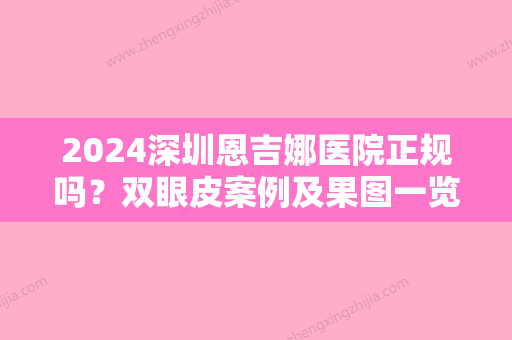 2024深圳恩吉娜医院正规吗？双眼皮案例及果图一览